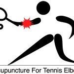 acupuncture for tennis elbow