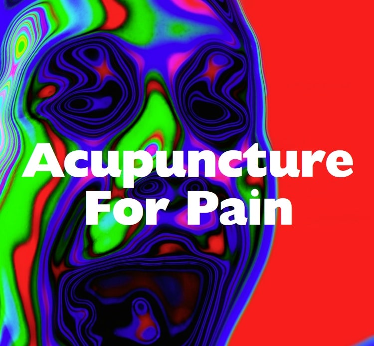 Acupuncture For Pain