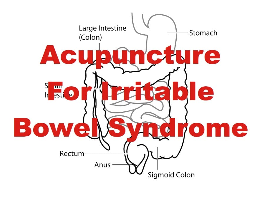 Acupuncture For Irritable Bowel Syndrome