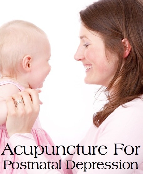 Acupuncture For Postnatal Depression