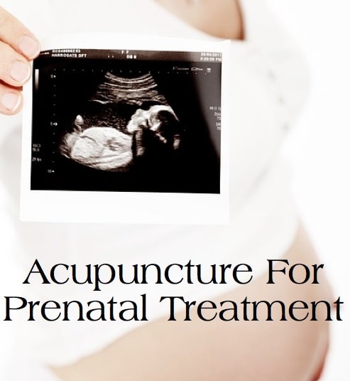 Acupuncture For Prenatal Treatment