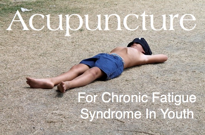 Acupuncture Treatment for Chronic Fatigue Syndrome in Youth